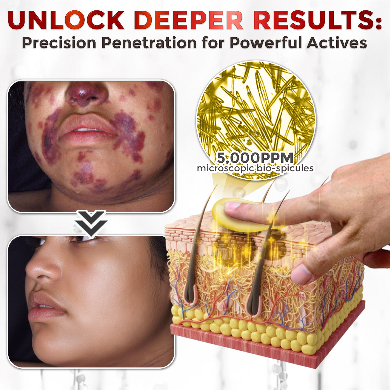 GFOUK® Bee Venom Comprehensive Repair Mcroneedle Cream 🇨🇦 Made in Canada