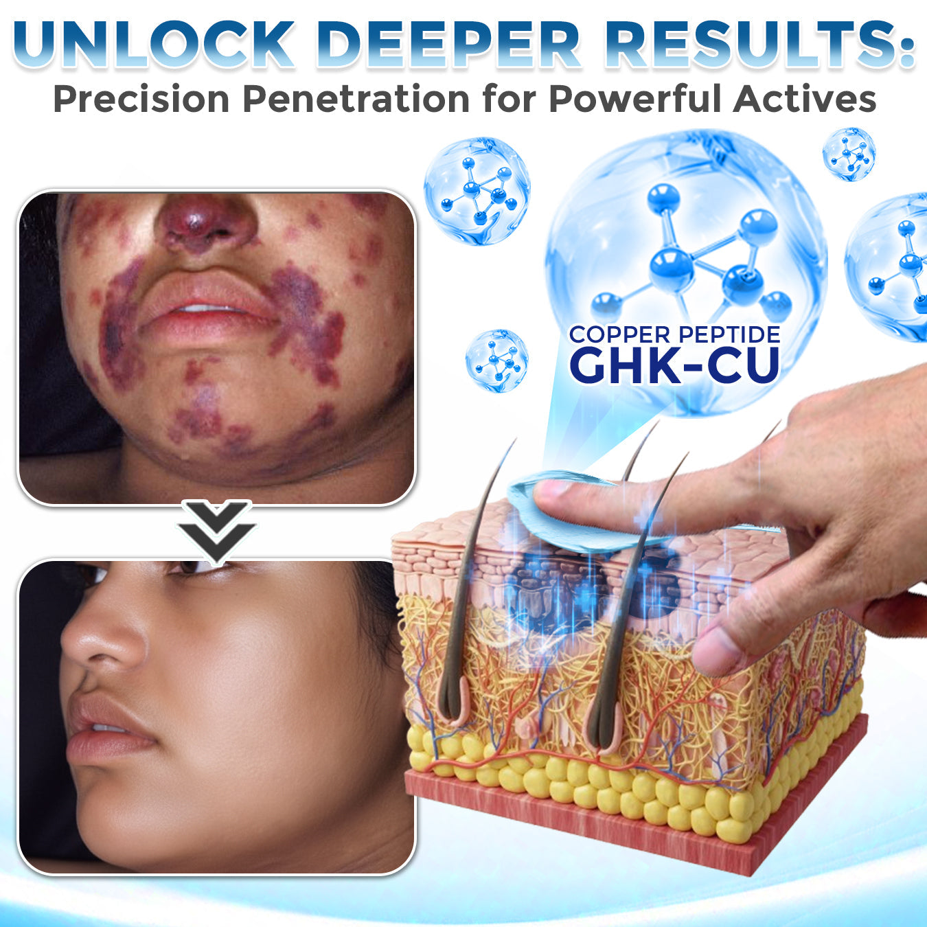 GFOUK® GHK-Cu Copper Peptide Comprehensive Cream 🇨🇦 Made in Canada