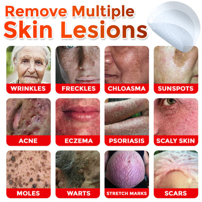 GFOUK® MicroNeedle Botanic Skin Tag Removal Patch 🇨🇦 Made in Canada