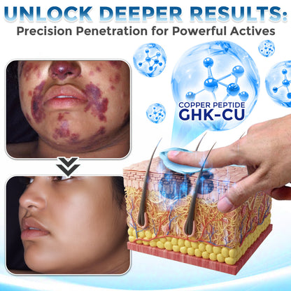 GFOUK® GHK-Cu Copper Peptide Comprehensive Cream 🇨🇦 Made in Canada